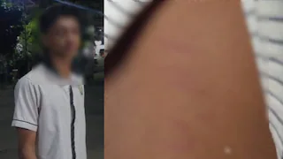 എട്ടാം ക്ലാസ് വിദ്യാർത്ഥിക്ക് ക്രൂര മർദനം